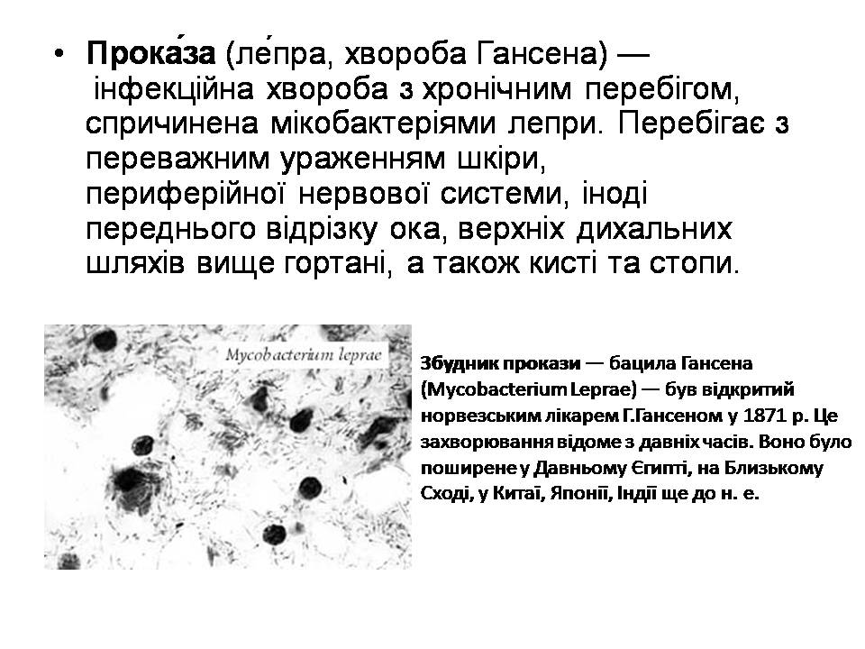 Презентація на тему «Інфекційні хвороби» (варіант 2) - Слайд #12 Презентація на тему «Інфекційні хвороби» (варіант 2) - Слайд #12