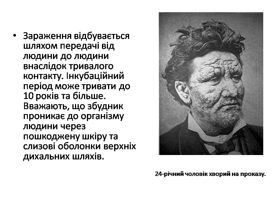 Презентація на тему «Інфекційні хвороби» (варіант 2) - Слайд #14 Презентація на тему «Інфекційні хвороби» (варіант 2) - Слайд #14