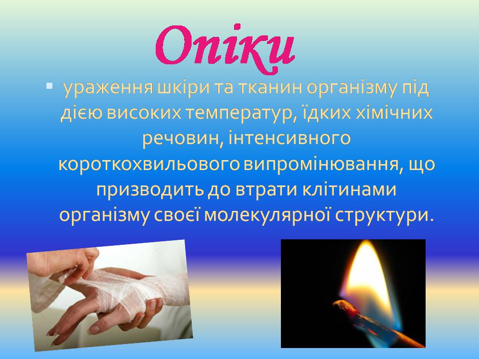 Презентація на тему «Опіки» (варіант 13) - Слайд #2 Презентація на тему «Опіки» (варіант 13) - Слайд #2