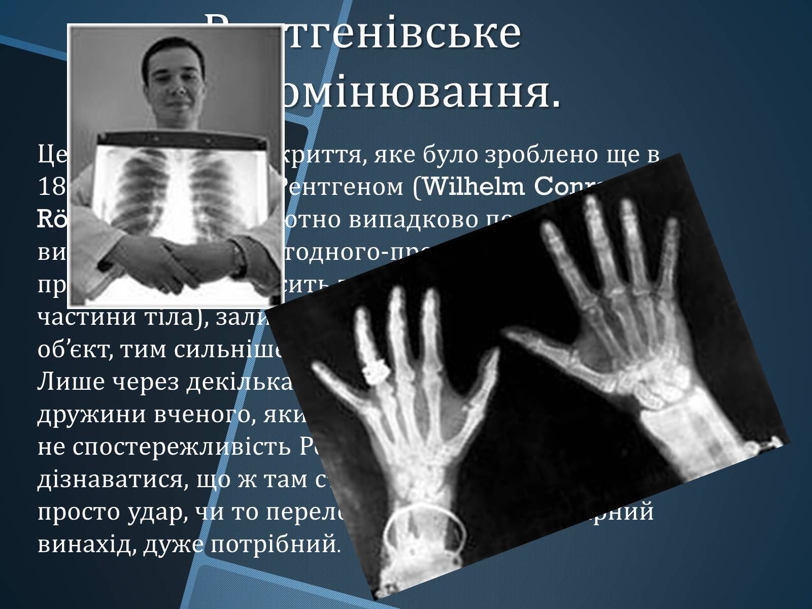 Презентація на тему «Випадкові винаходи» - Слайд #4 Презентація на тему «Випадкові винаходи» - Слайд #4