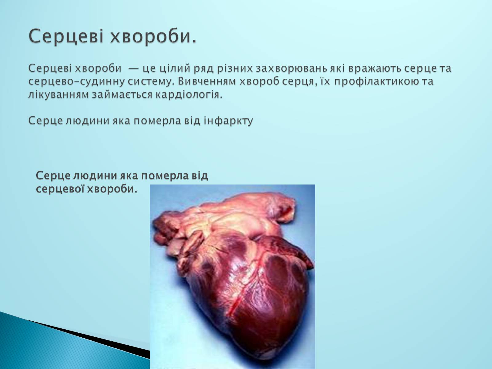 Презентація на тему «Серце. Його робота та хвороби» - Слайд #6 Презентація на тему «Серце. Його робота та хвороби» - Слайд #6