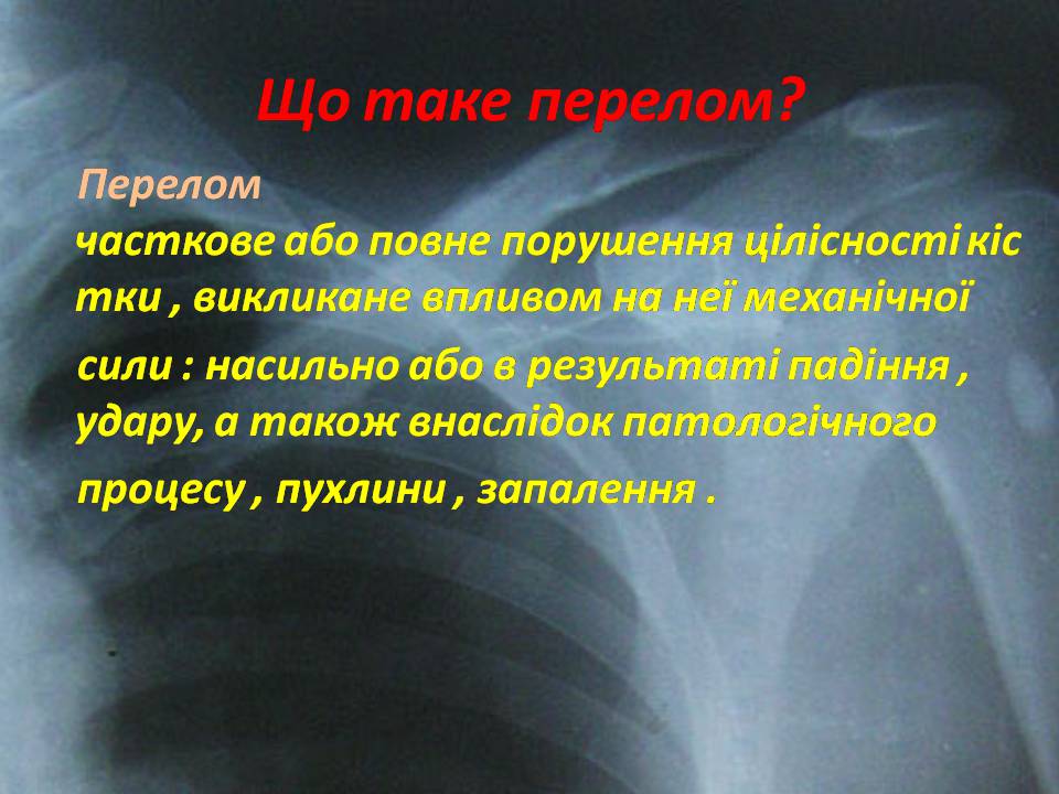Презентація на тему «Правила надання першої допомоги ?при переломах» - Слайд #4 Презентація на тему «Правила надання першої допомоги ?при переломах» - Слайд #4