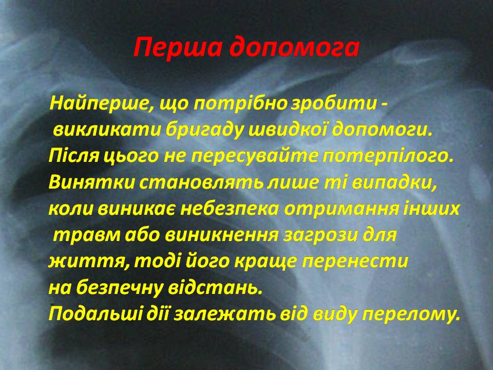 Презентація на тему «Правила надання першої допомоги ?при переломах» - Слайд #8 Презентація на тему «Правила надання першої допомоги ?при переломах» - Слайд #8