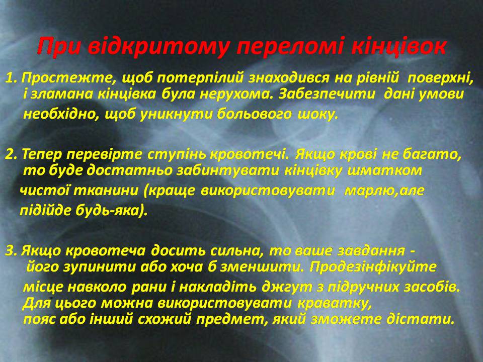 Презентація на тему «Правила надання першої допомоги ?при переломах» - Слайд #9 Презентація на тему «Правила надання першої допомоги ?при переломах» - Слайд #9