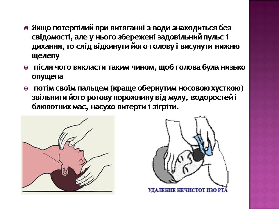 Презентація на тему «Перша допомога при утопленні» (варіант 4) - Слайд #8 Презентація на тему «Перша допомога при утопленні» (варіант 4) - Слайд #8