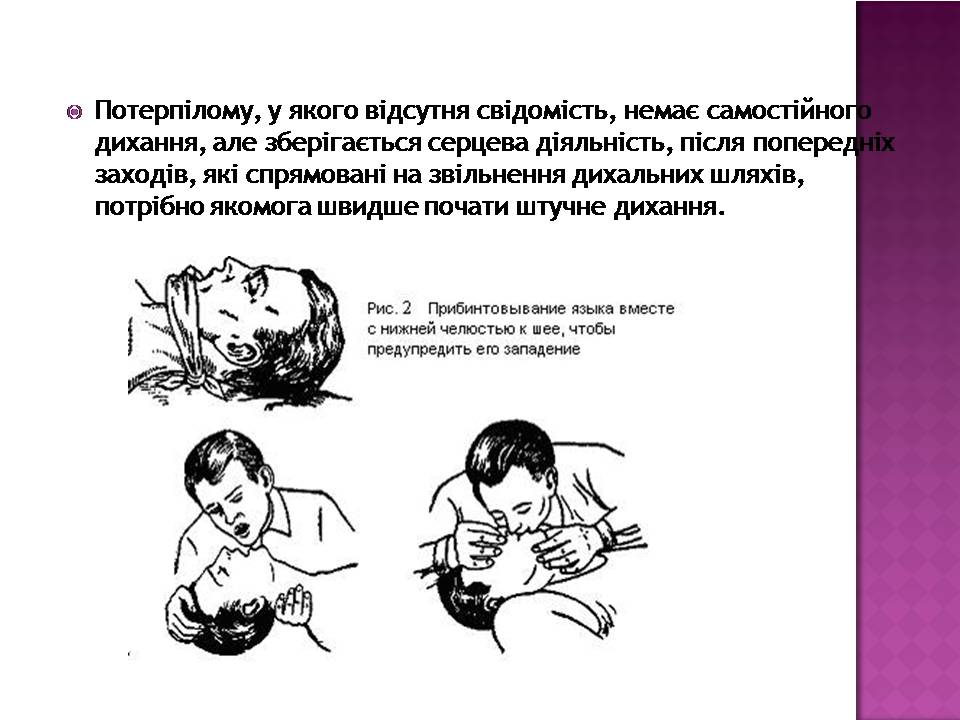Презентація на тему «Перша допомога при утопленні» (варіант 4) - Слайд #9 Презентація на тему «Перша допомога при утопленні» (варіант 4) - Слайд #9