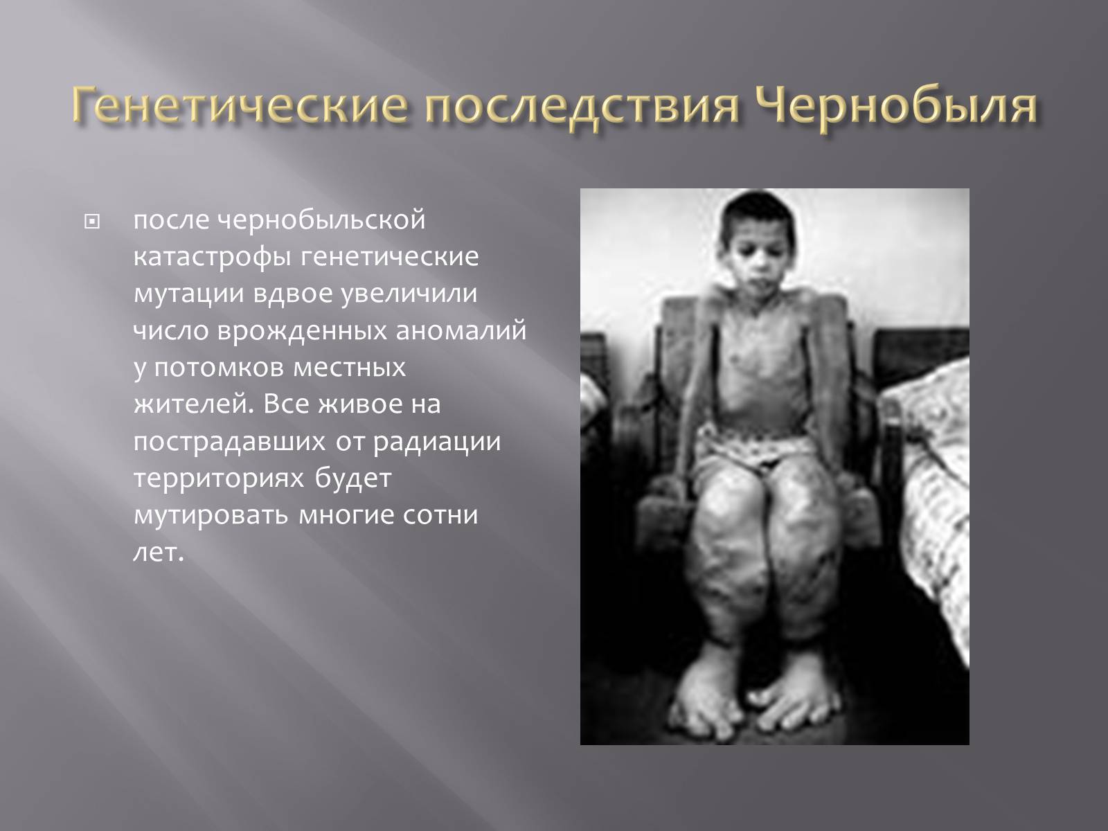 Презентація на тему «Авария на Чернобыльской атомной электростанции» - Слайд #7 Презентація на тему «Авария на Чернобыльской атомной электростанции» - Слайд #7