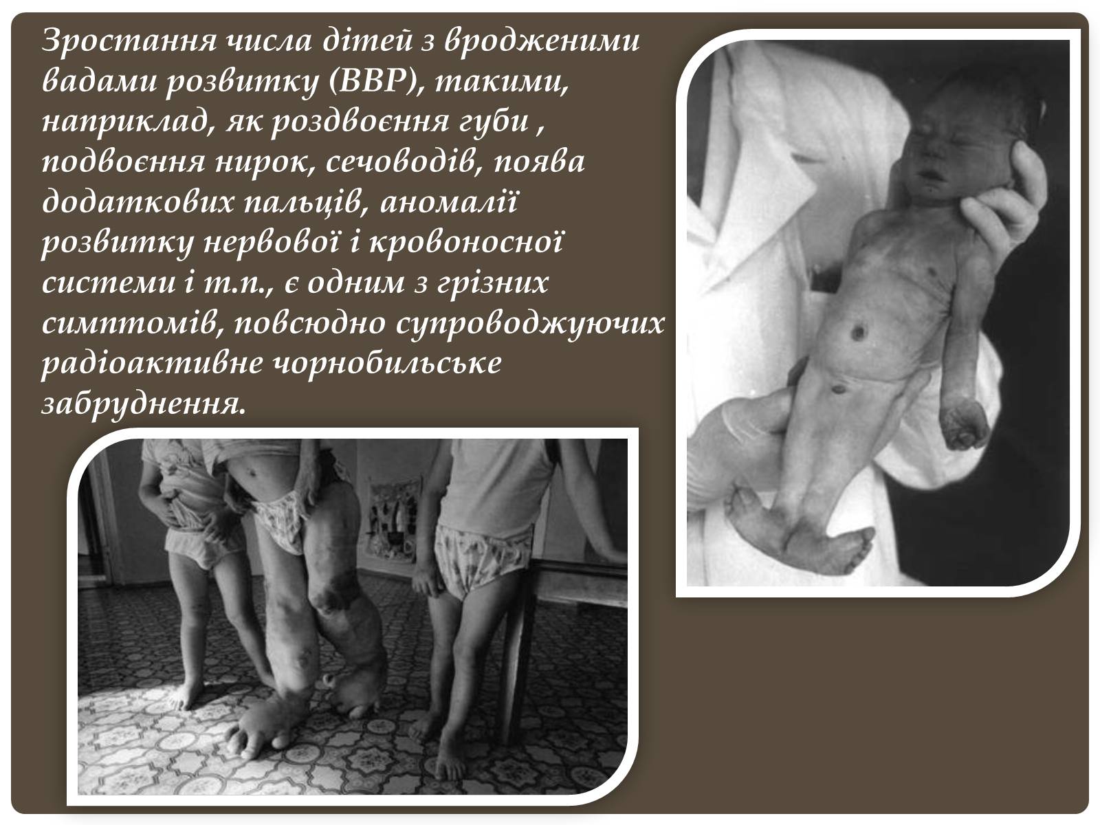 Презентація на тему «Чорнобиль» (варіант 6) - Слайд #24 Презентація на тему «Чорнобиль» (варіант 6) - Слайд #24