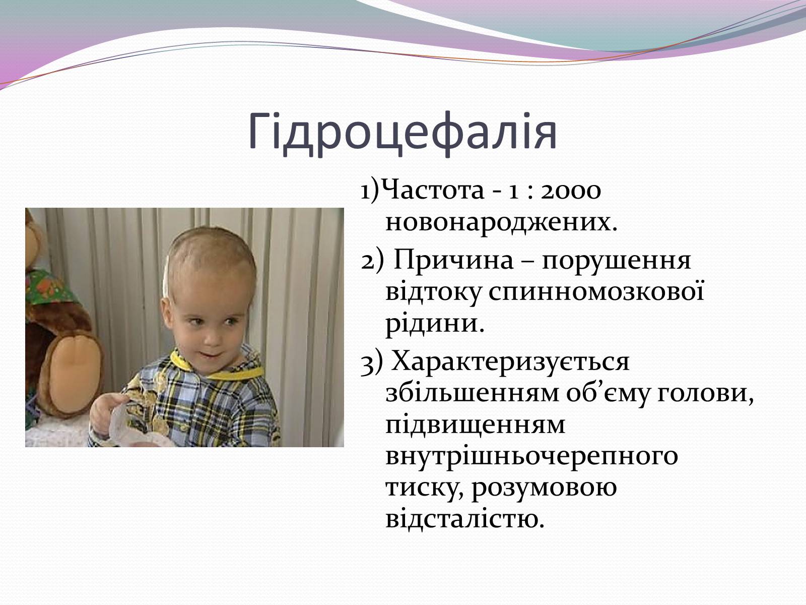 Презентація на тему «Спадкові хвороби» (варіант 1) - Слайд #13 Презентація на тему «Спадкові хвороби» (варіант 1) - Слайд #13