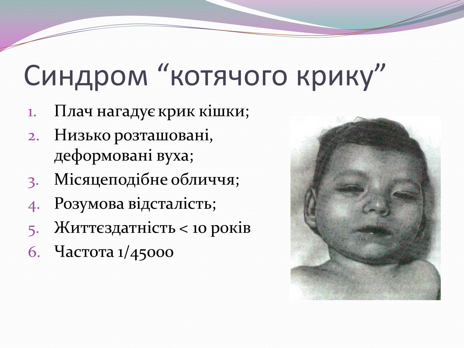 Презентація на тему «Спадкові хвороби» (варіант 1) - Слайд #8 Презентація на тему «Спадкові хвороби» (варіант 1) - Слайд #8