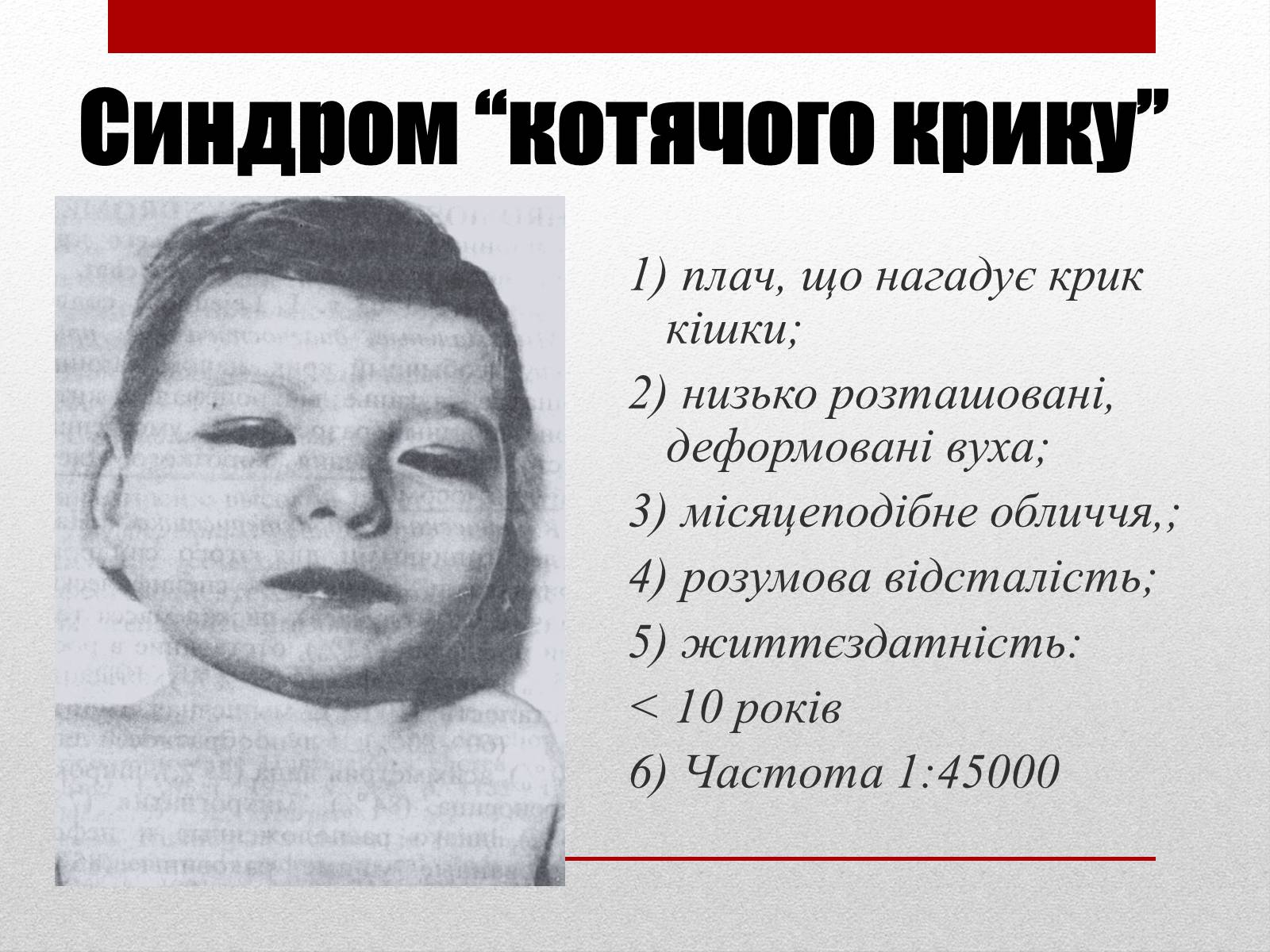 Презентація на тему «Спадкові хвороби людини» - Слайд #12 Презентація на тему «Спадкові хвороби людини» - Слайд #12