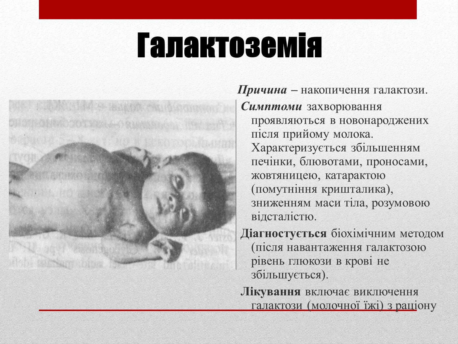 Презентація на тему «Спадкові хвороби людини» - Слайд #15 Презентація на тему «Спадкові хвороби людини» - Слайд #15