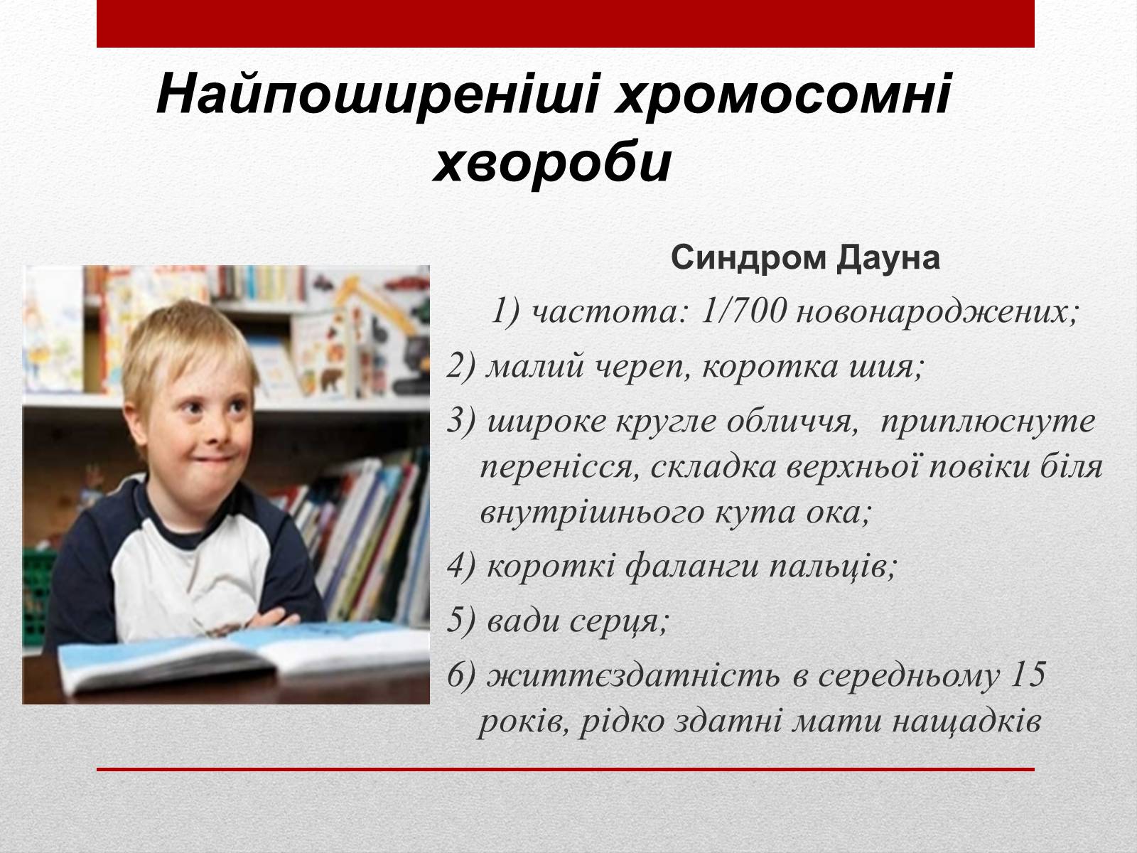 Презентація на тему «Спадкові хвороби людини» - Слайд #7 Презентація на тему «Спадкові хвороби людини» - Слайд #7