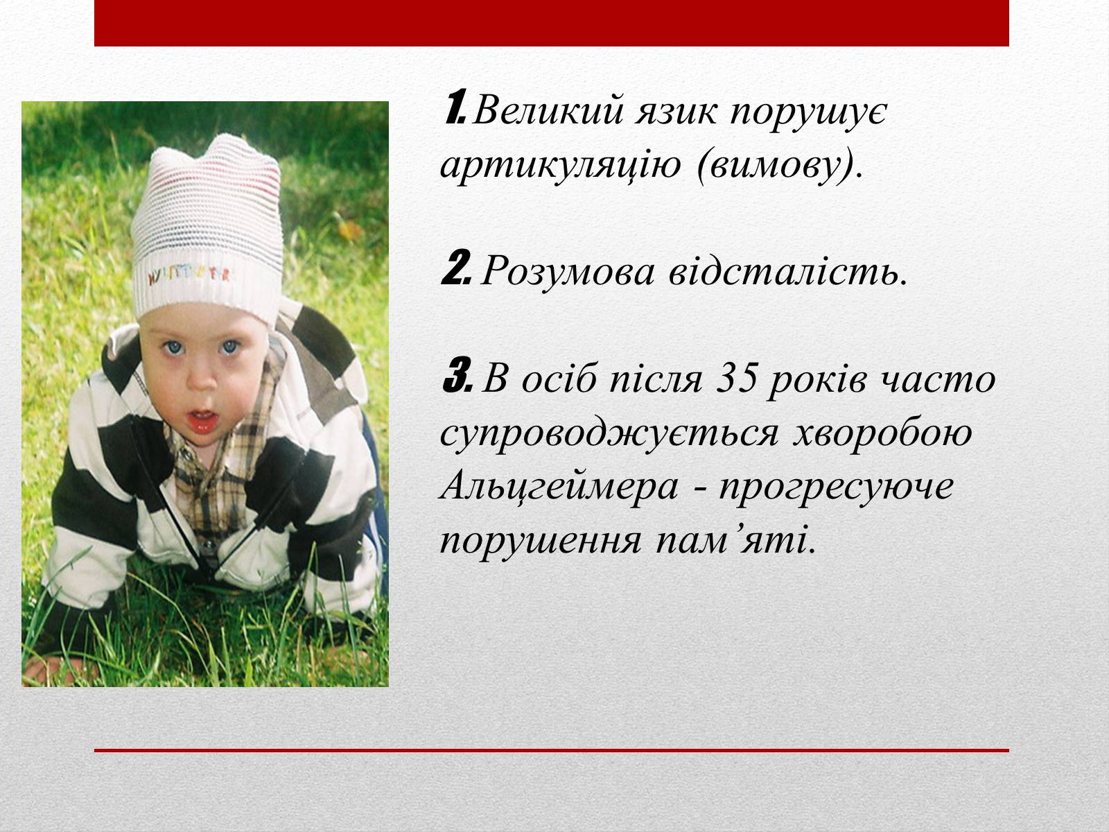 Презентація на тему «Спадкові хвороби людини» - Слайд #8 Презентація на тему «Спадкові хвороби людини» - Слайд #8