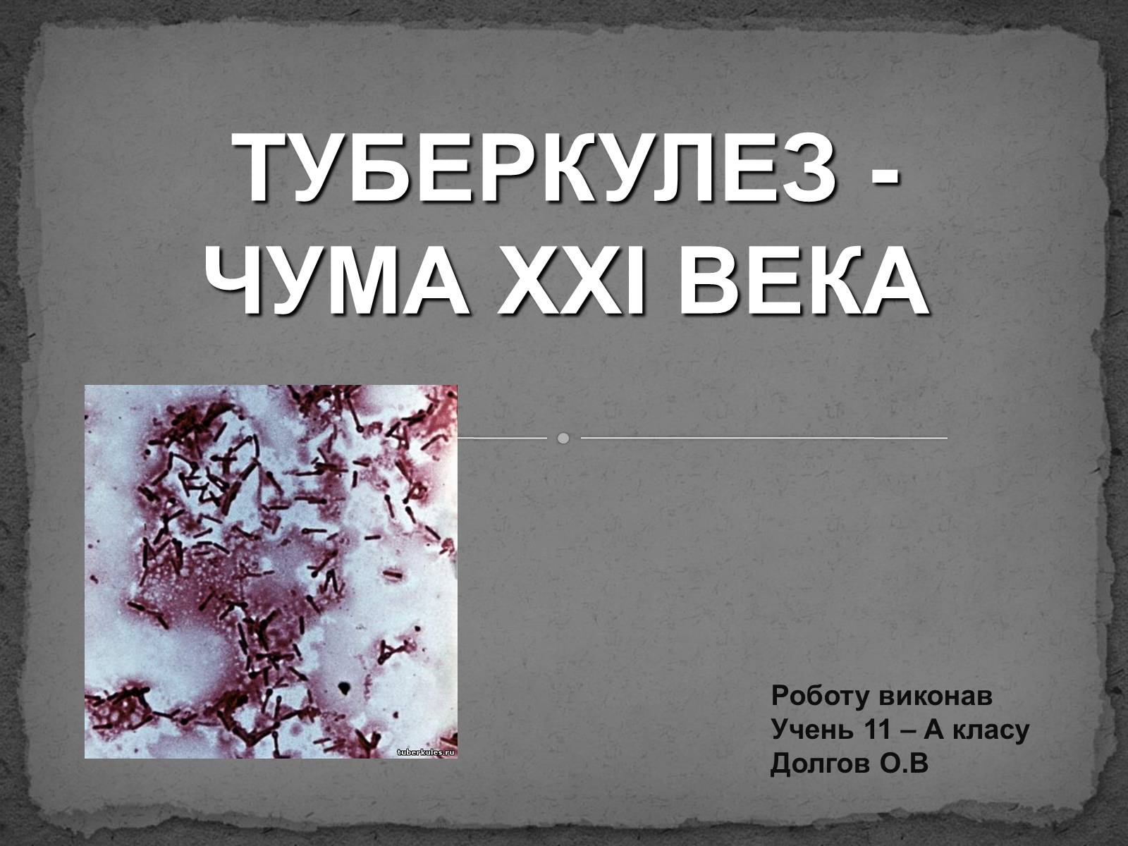 Презентація на тему «Туберкулез» (варіант 1) - Слайд #1 Презентація на тему «Туберкулез» (варіант 1) - Слайд #1
