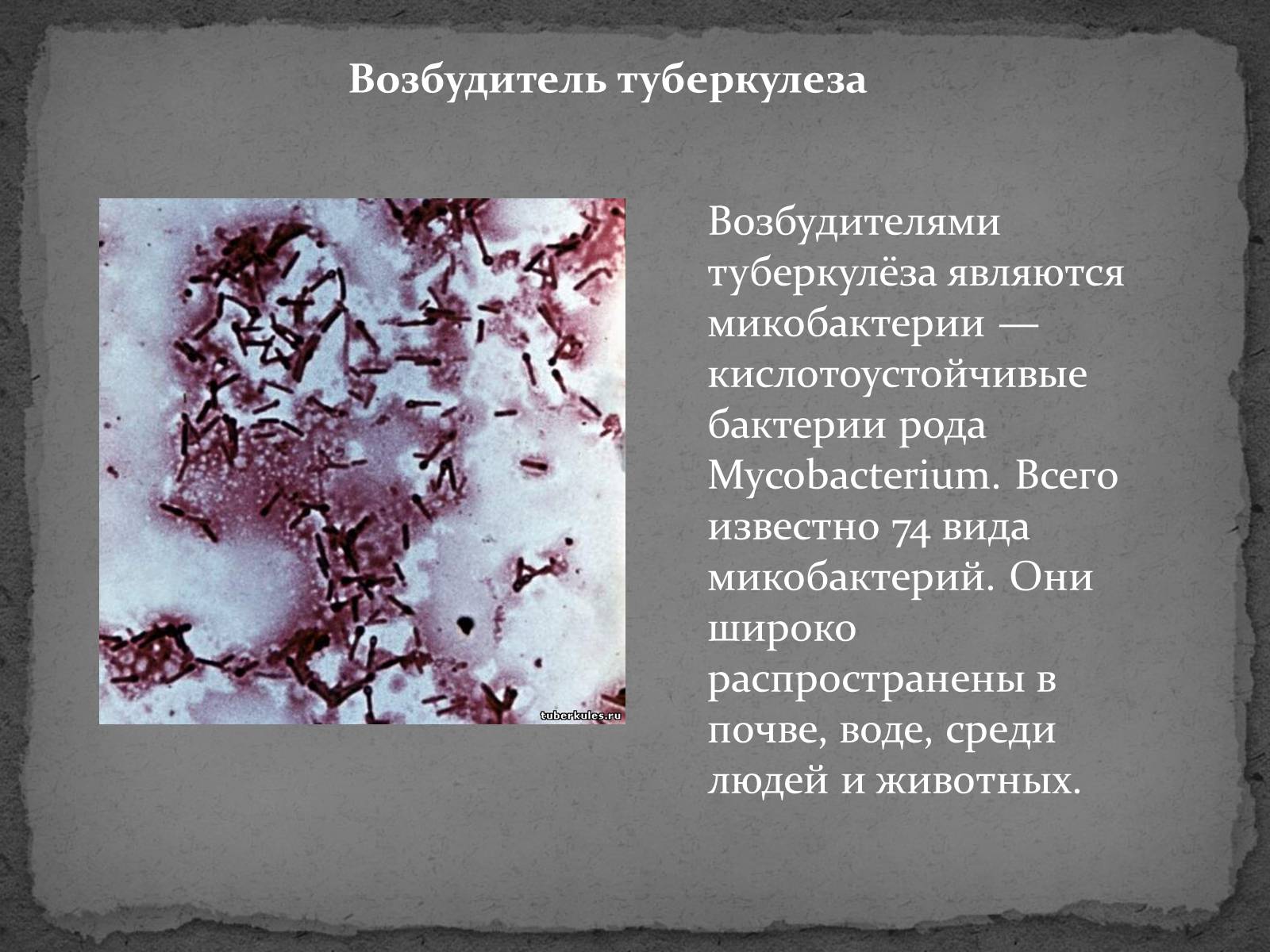 Презентація на тему «Туберкулез» (варіант 1) - Слайд #2 Презентація на тему «Туберкулез» (варіант 1) - Слайд #2