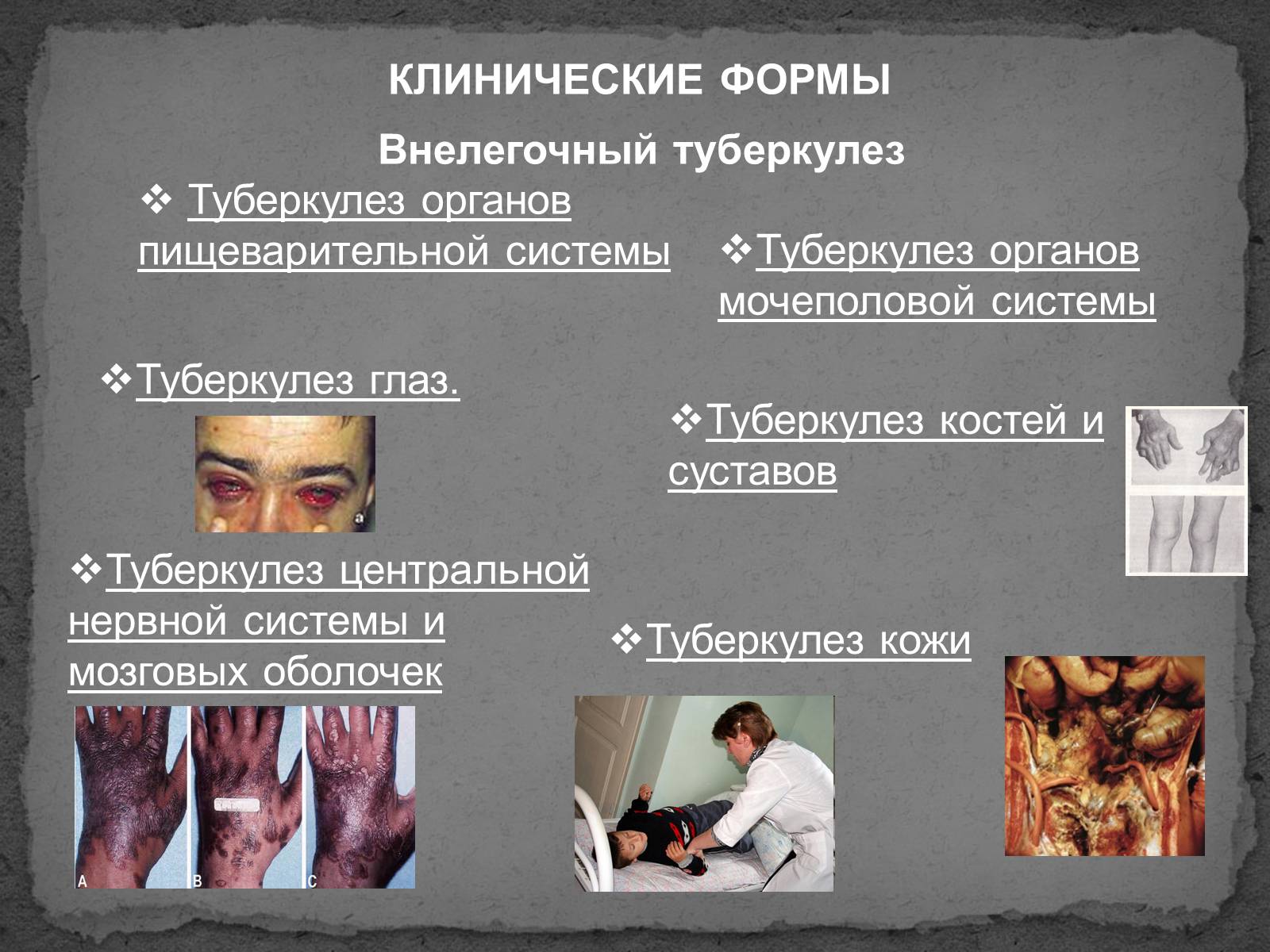 Презентація на тему «Туберкулез» (варіант 1) - Слайд #3 Презентація на тему «Туберкулез» (варіант 1) - Слайд #3