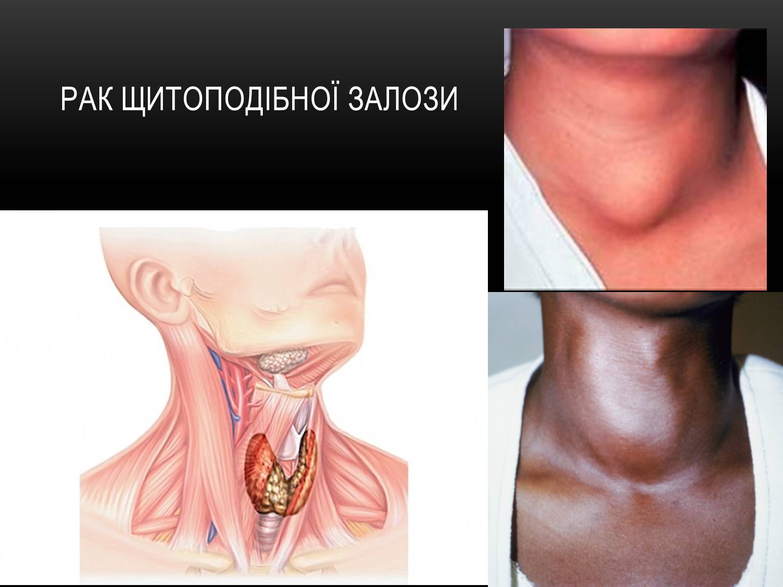 Презентація на тему «Чорно?бильська катастро?фа» - Слайд #33 Презентація на тему «Чорно?бильська катастро?фа» - Слайд #33