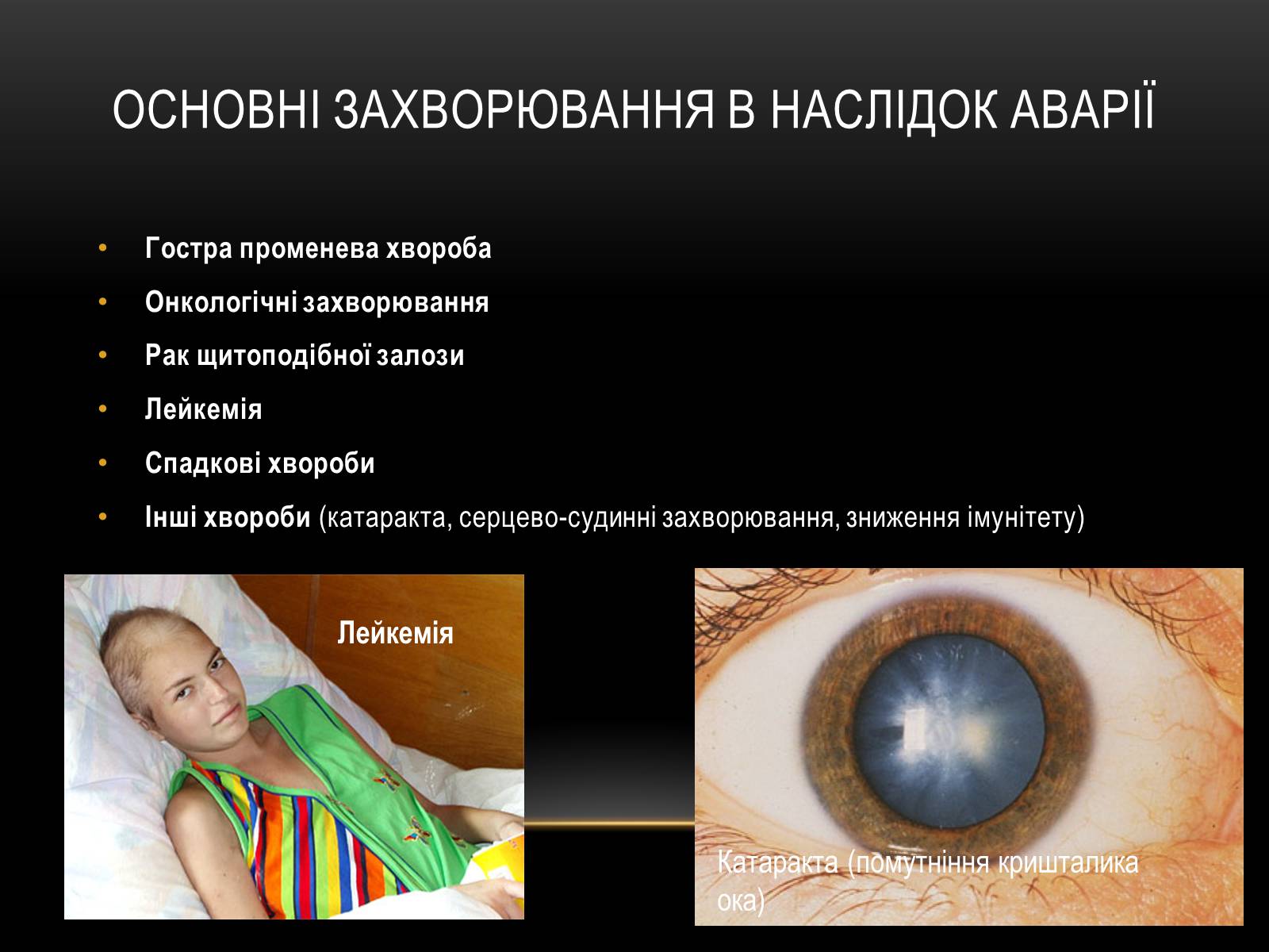 Презентація на тему «Чорно?бильська катастро?фа» - Слайд #37 Презентація на тему «Чорно?бильська катастро?фа» - Слайд #37