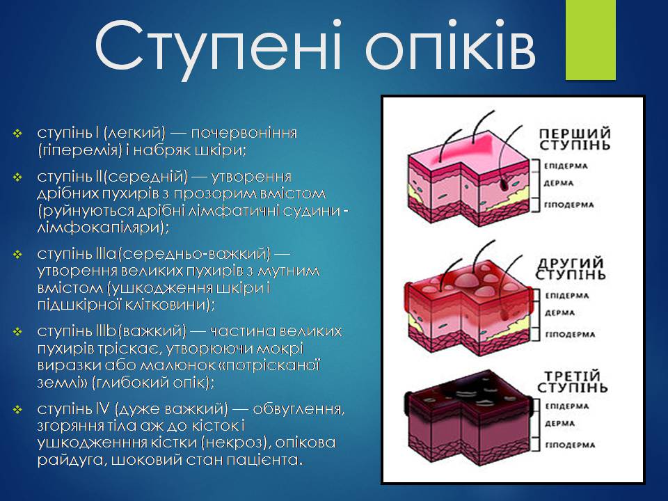 Презентація на тему «Опіки. Види опіків. Перша допомога при опіках» - Слайд #4 Презентація на тему «Опіки. Види опіків. Перша допомога при опіках» - Слайд #4