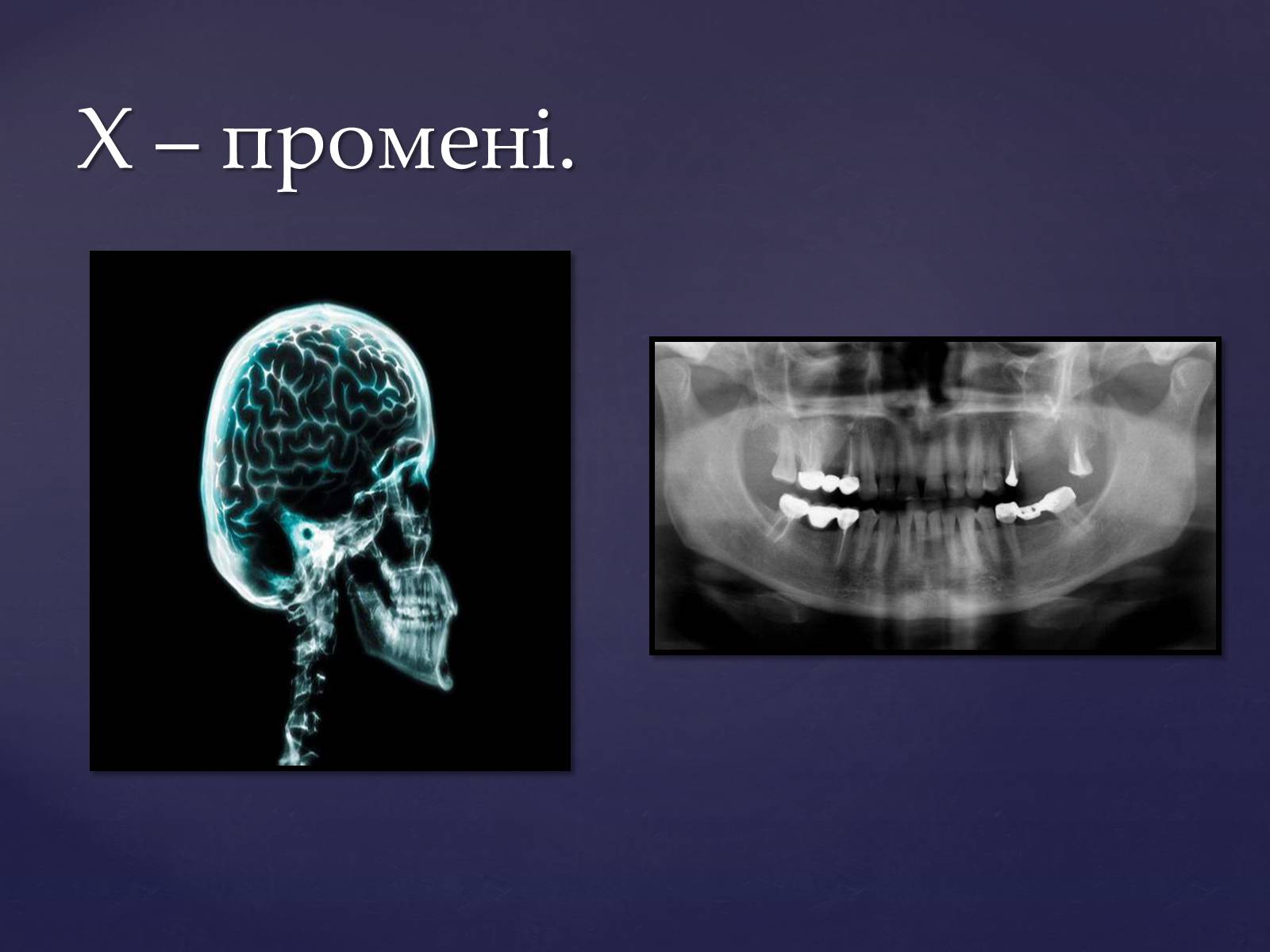 Презентація на тему «Електромагнітні хвилі в природі і техніці» (варіант 4) - Слайд #20 Презентація на тему «Електромагнітні хвилі в природі і техніці» (варіант 4) - Слайд #20
