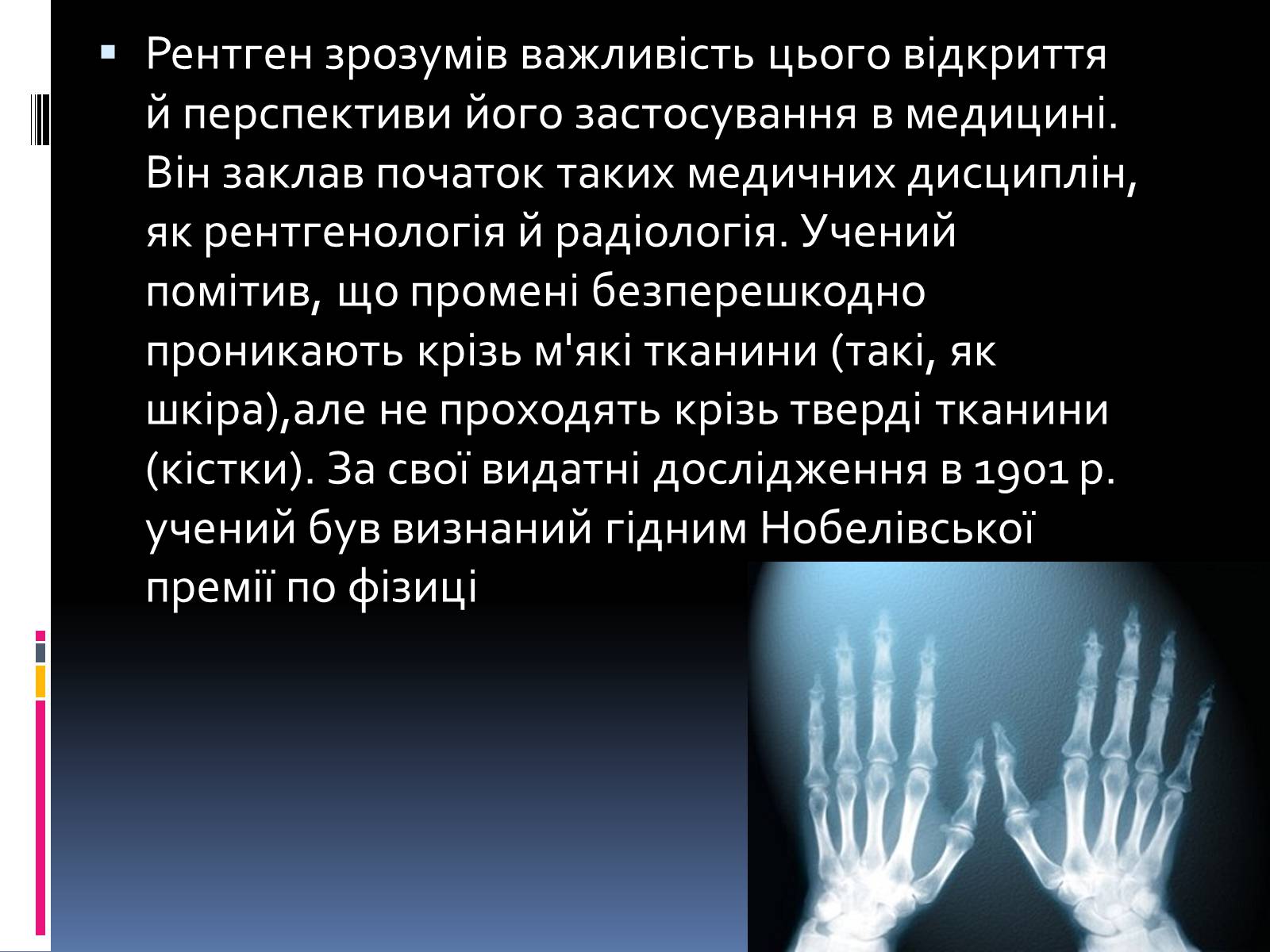 Презентація на тему «Рентгенівське випромінювання» (варіант 1) - Слайд #4 Презентація на тему «Рентгенівське випромінювання» (варіант 1) - Слайд #4