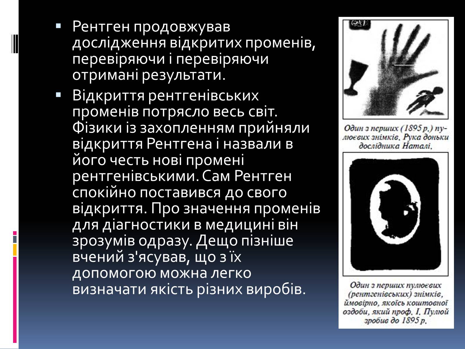 Презентація на тему «Рентгенівське випромінювання» (варіант 1) - Слайд #5 Презентація на тему «Рентгенівське випромінювання» (варіант 1) - Слайд #5