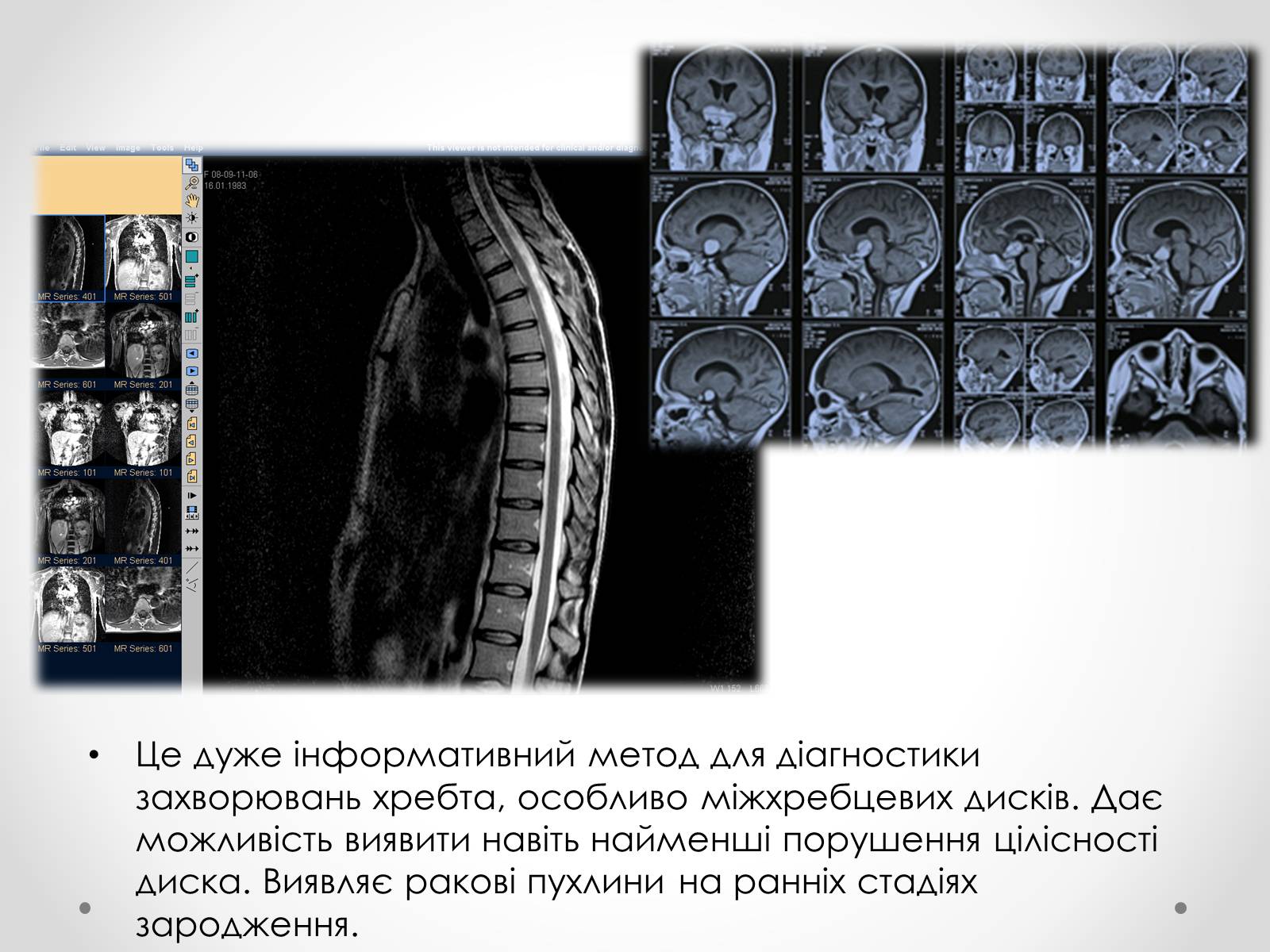 Презентація на тему «Резонанс у медицині» - Слайд #8 Презентація на тему «Резонанс у медицині» - Слайд #8