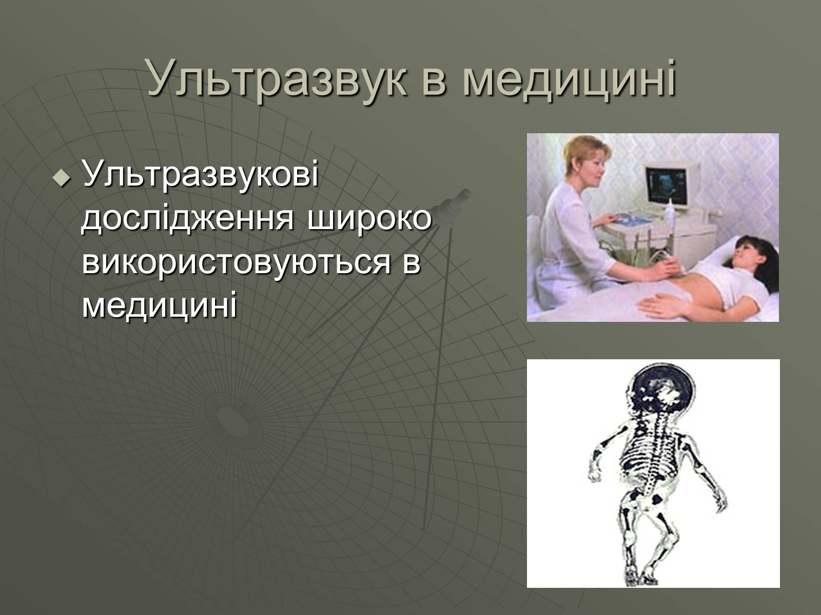 Презентація на тему «УЛЬТРАЗВУК та ІНФРАЗВУК» (варіант 1) - Слайд #7 Презентація на тему «УЛЬТРАЗВУК та ІНФРАЗВУК» (варіант 1) - Слайд #7