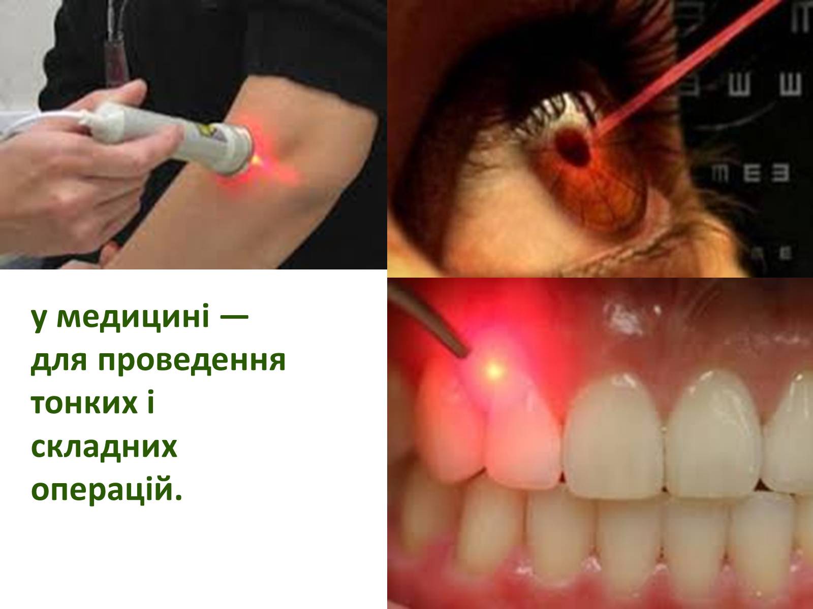 Презентація на тему «Квантові генератори та їх застосування» - Слайд #10 Презентація на тему «Квантові генератори та їх застосування» - Слайд #10