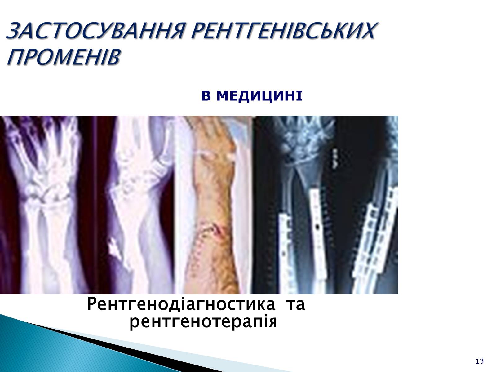 Презентація на тему «Рентгенівське випромінювання» (варіант 5) - Слайд #13 Презентація на тему «Рентгенівське випромінювання» (варіант 5) - Слайд #13