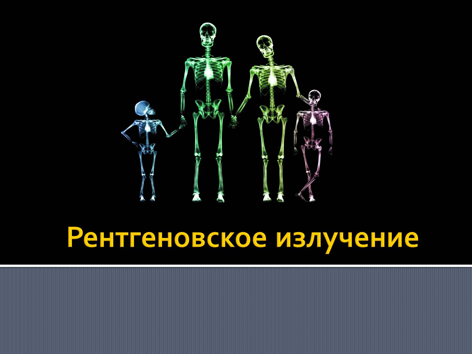 Презентація на тему «Рентгеновское излучение» - Слайд #1 Презентація на тему «Рентгеновское излучение» - Слайд #1