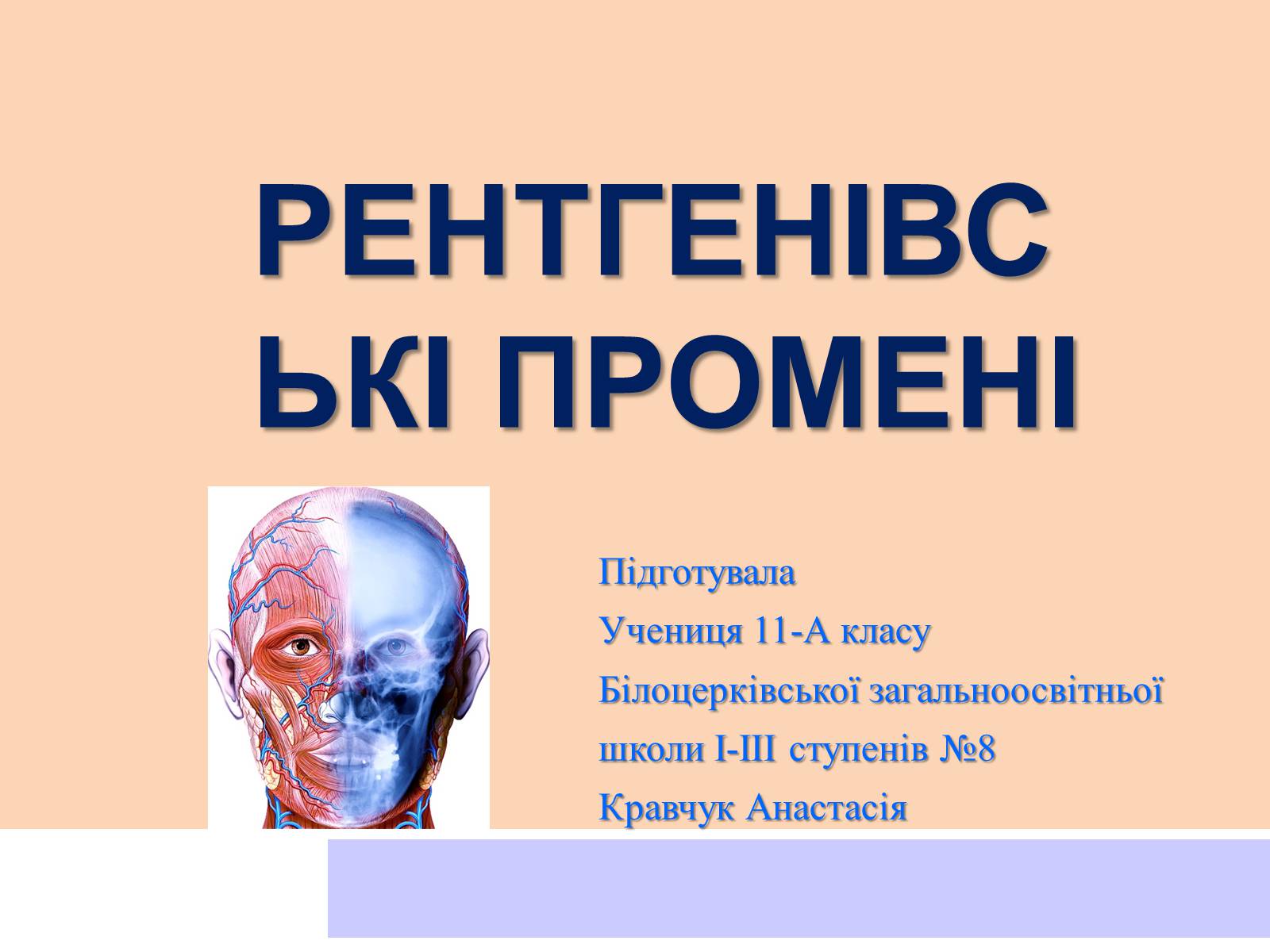 Презентація на тему «Рентгенівські промені» - Слайд #1 Презентація на тему «Рентгенівські промені» - Слайд #1