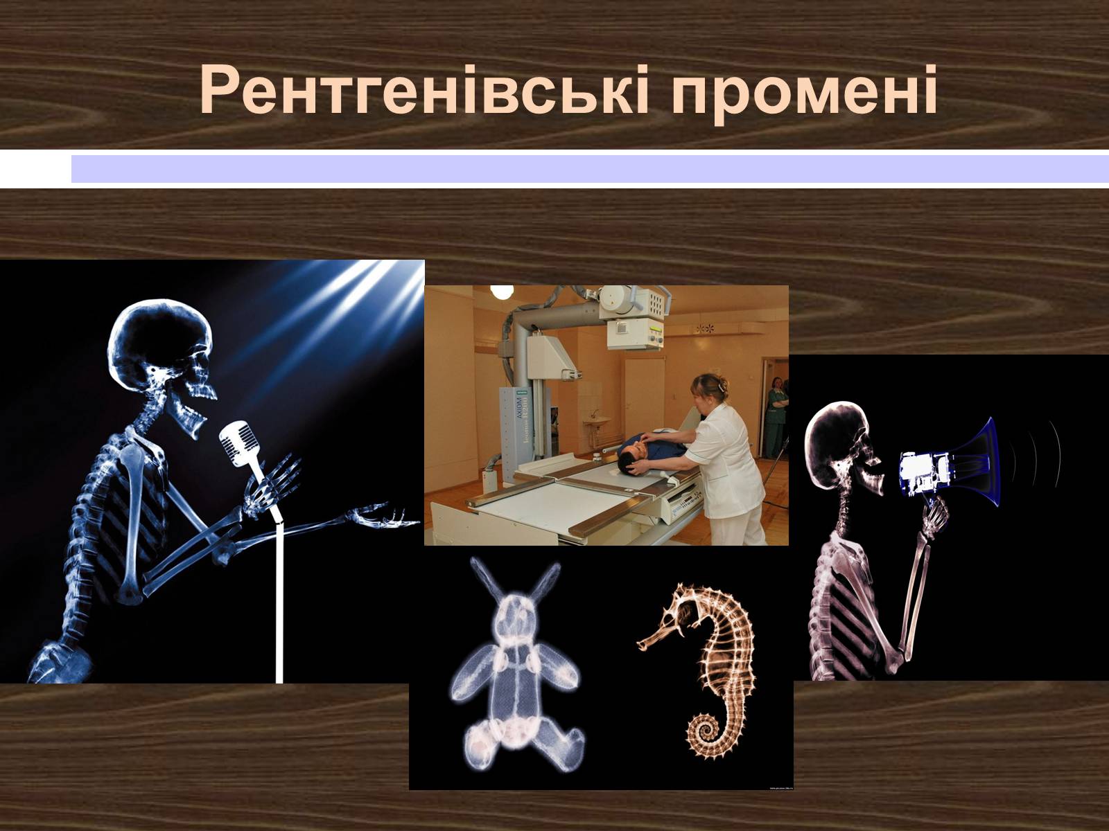 Презентація на тему «Рентгенівські промені» - Слайд #11 Презентація на тему «Рентгенівські промені» - Слайд #11
