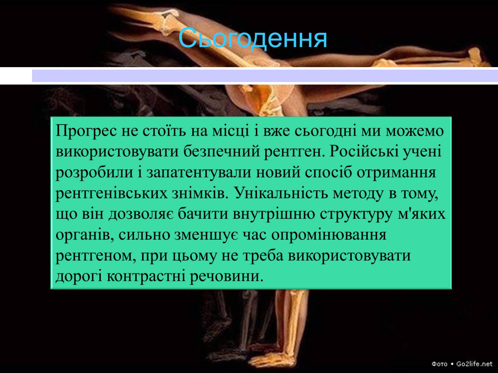 Презентація на тему «Рентгенівські промені» - Слайд #21 Презентація на тему «Рентгенівські промені» - Слайд #21