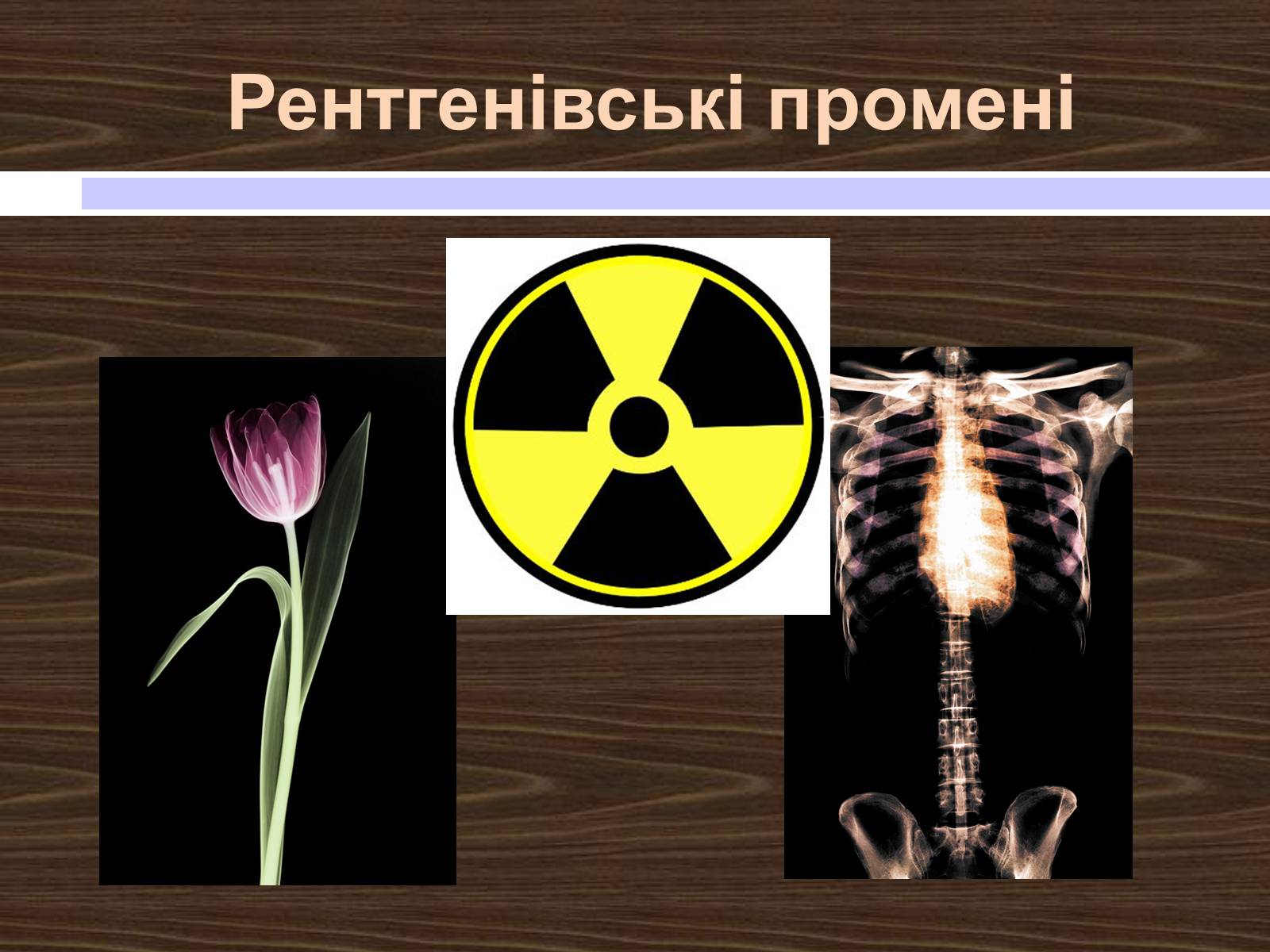 Презентація на тему «Рентгенівські промені» - Слайд #5 Презентація на тему «Рентгенівські промені» - Слайд #5