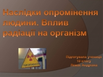 Презентація на тему «Наслідки опромінення людини»