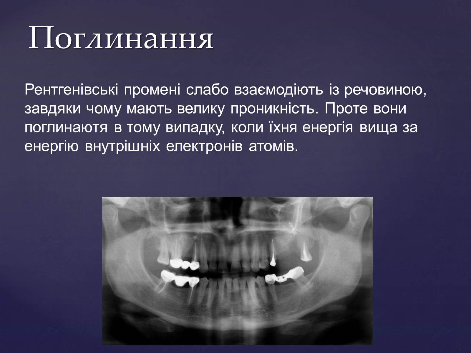 Презентація на тему «Рентгенівське випромінювання» (варіант 2) - Слайд #11 Презентація на тему «Рентгенівське випромінювання» (варіант 2) - Слайд #11