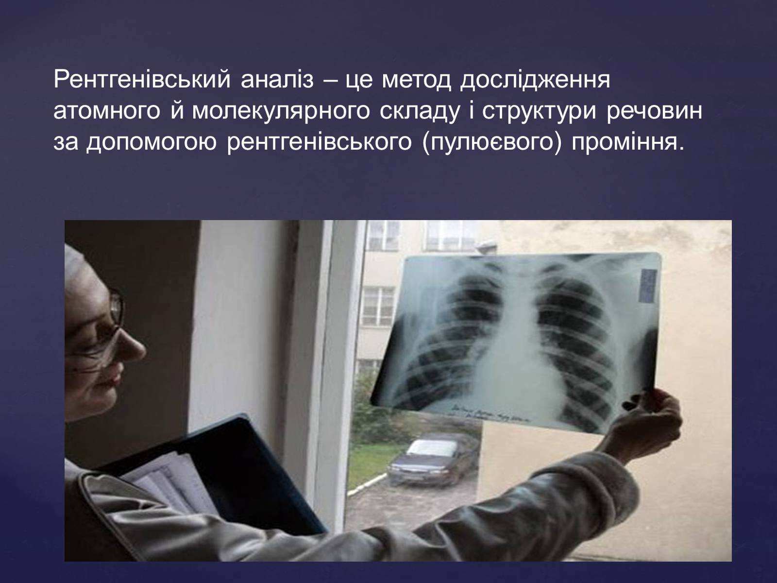 Презентація на тему «Рентгенівське випромінювання» (варіант 2) - Слайд #16 Презентація на тему «Рентгенівське випромінювання» (варіант 2) - Слайд #16