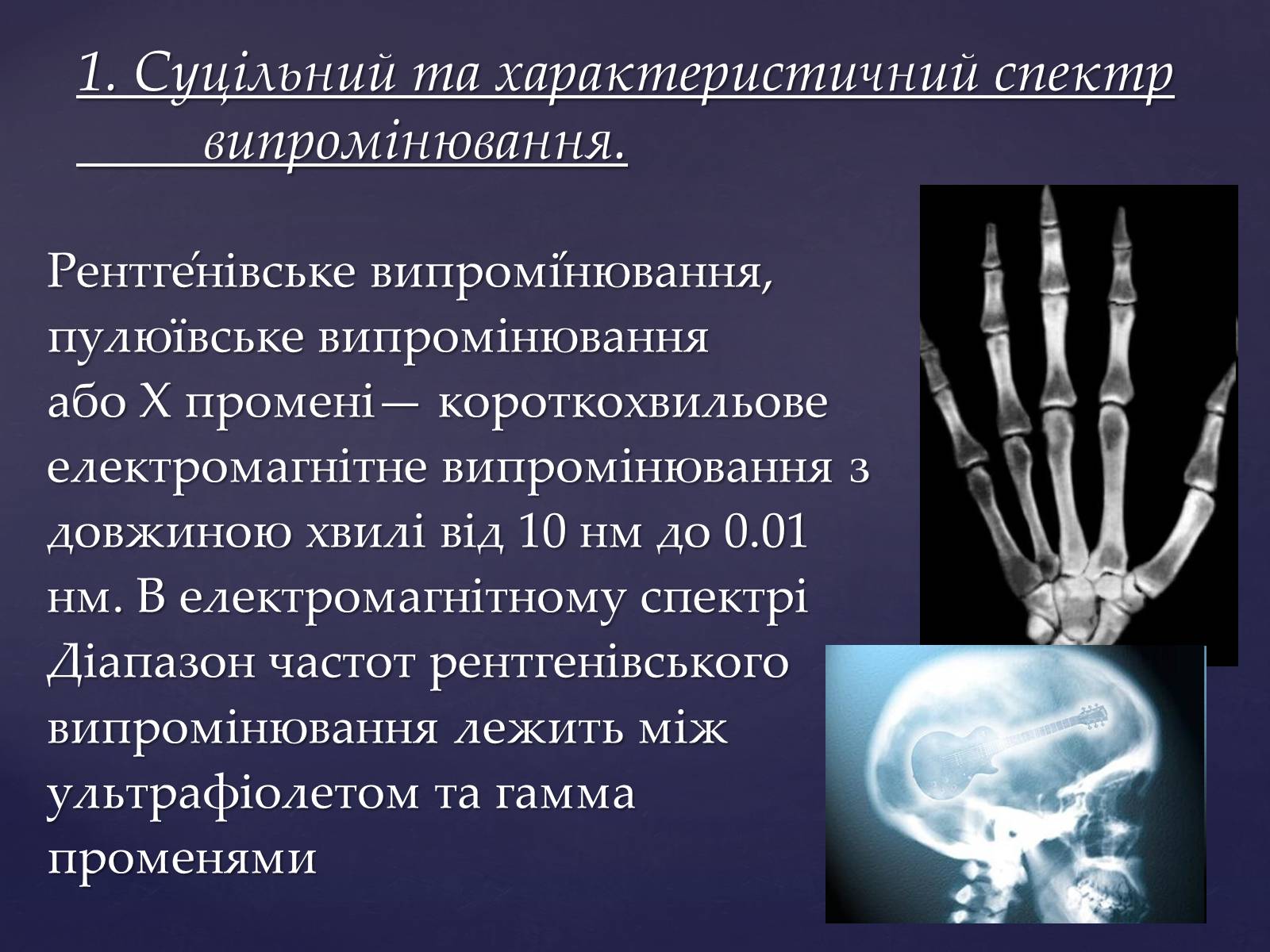 Презентація на тему «Рентгенівське випромінювання» (варіант 2) - Слайд #3 Презентація на тему «Рентгенівське випромінювання» (варіант 2) - Слайд #3