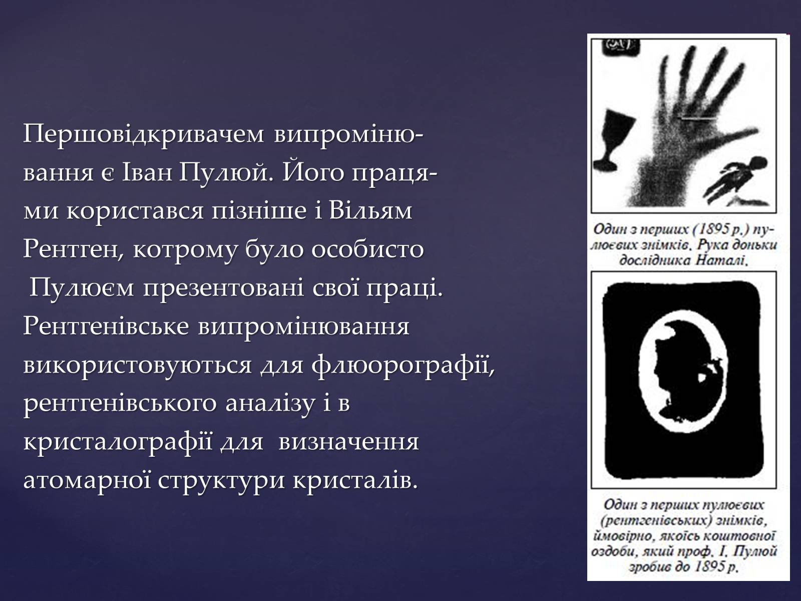 Презентація на тему «Рентгенівське випромінювання» (варіант 2) - Слайд #7 Презентація на тему «Рентгенівське випромінювання» (варіант 2) - Слайд #7
