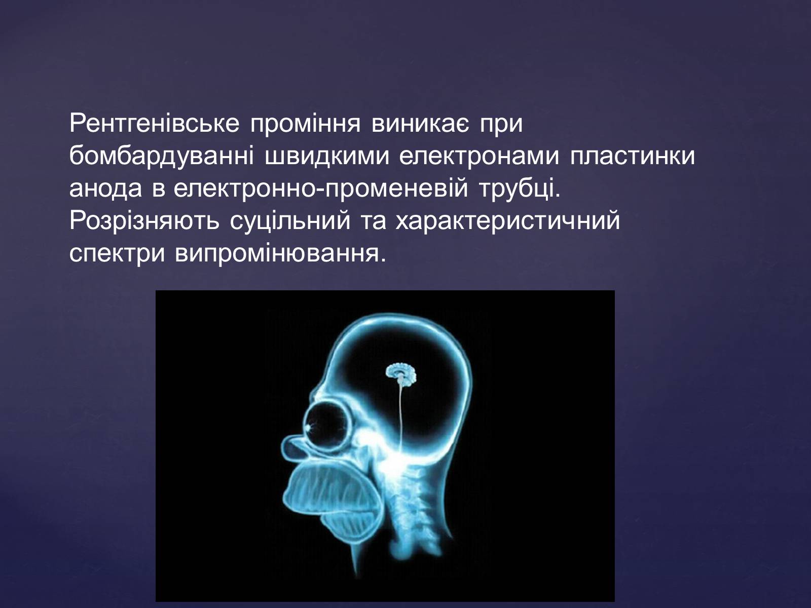 Презентація на тему «Рентгенівське випромінювання» (варіант 2) - Слайд #8 Презентація на тему «Рентгенівське випромінювання» (варіант 2) - Слайд #8