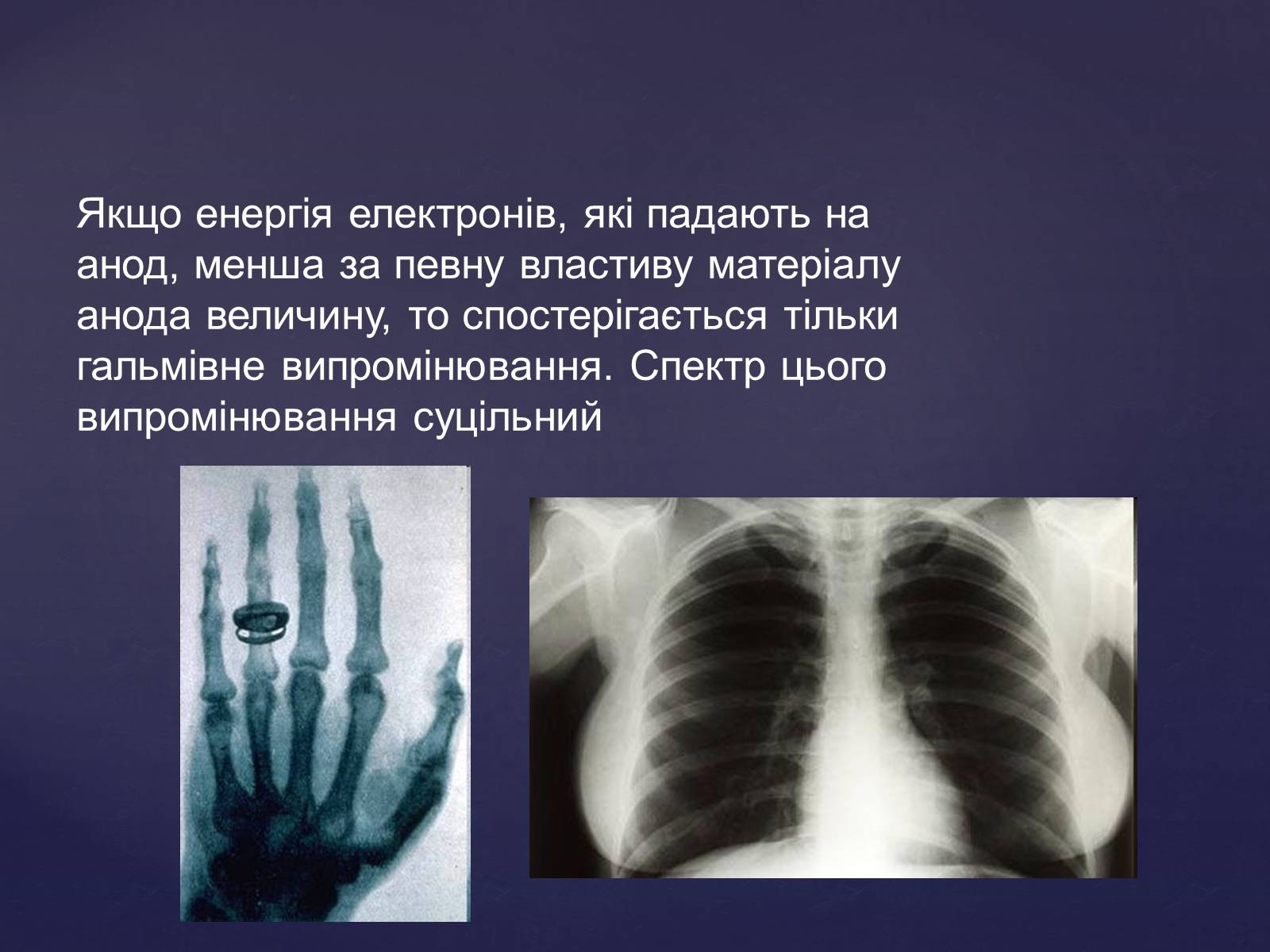 Презентація на тему «Рентгенівське випромінювання» (варіант 2) - Слайд #9 Презентація на тему «Рентгенівське випромінювання» (варіант 2) - Слайд #9