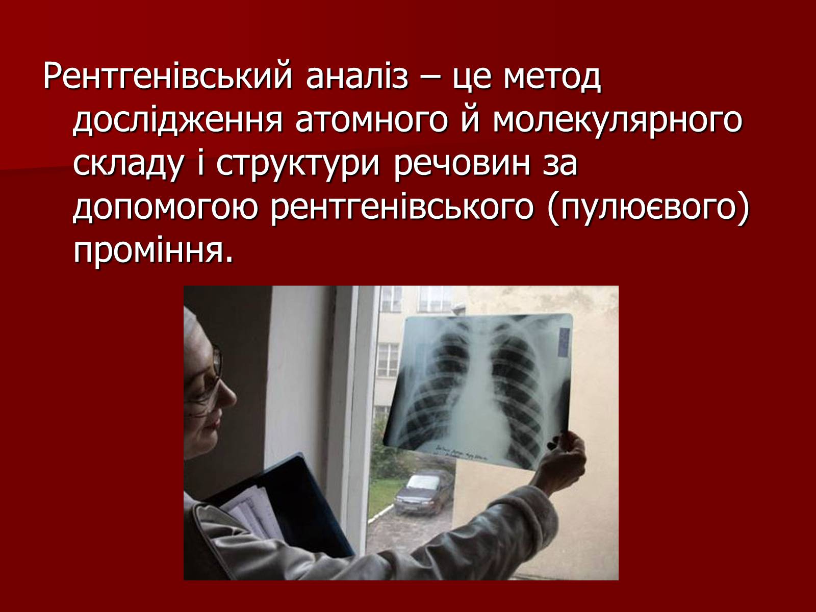 Презентація на тему «Рентгенівське випромінювання» (варіант 10) - Слайд #14 Презентація на тему «Рентгенівське випромінювання» (варіант 10) - Слайд #14