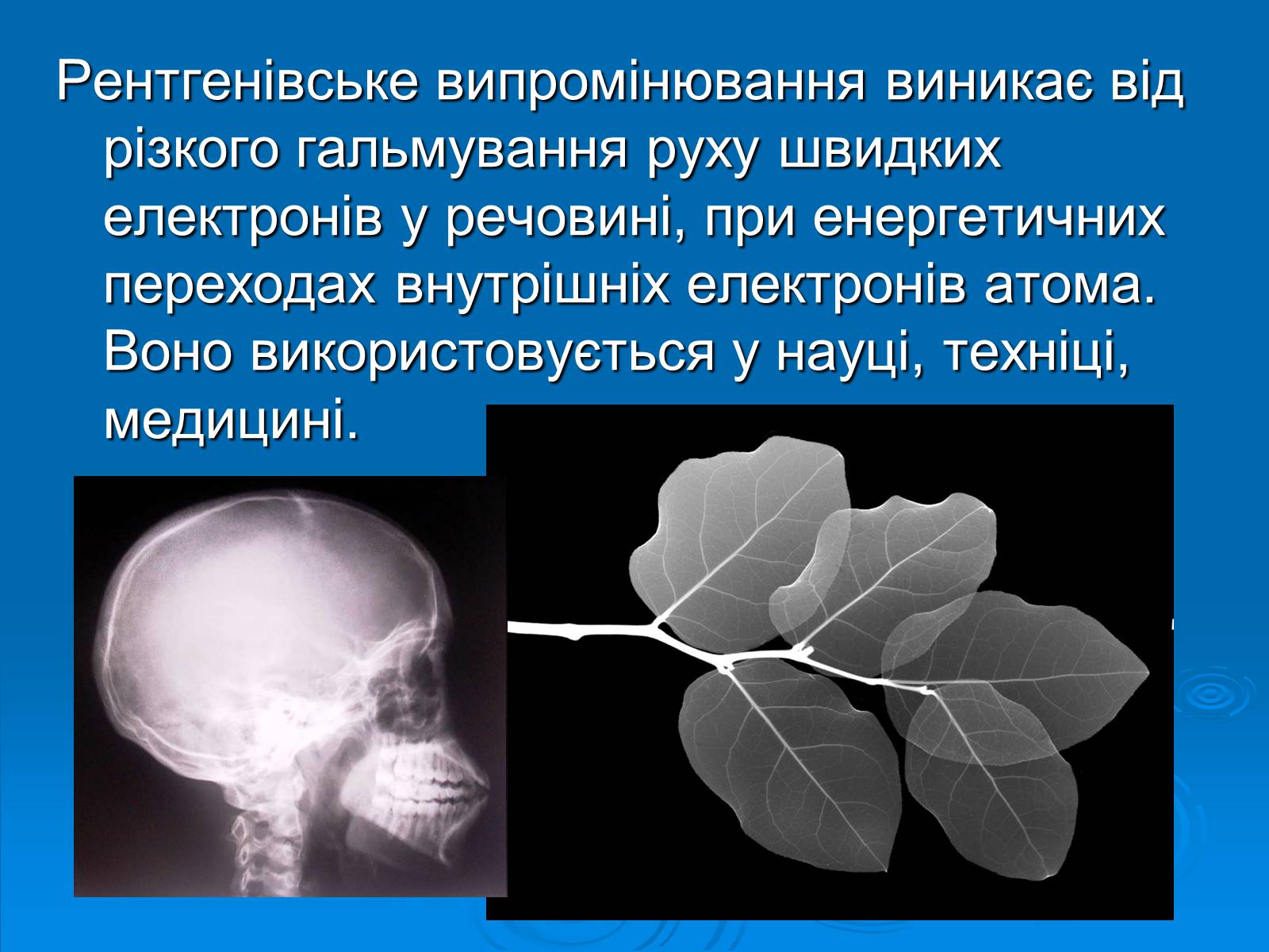 Презентація на тему «Рентгенівське випромінювання» (варіант 10) - Слайд #3 Презентація на тему «Рентгенівське випромінювання» (варіант 10) - Слайд #3