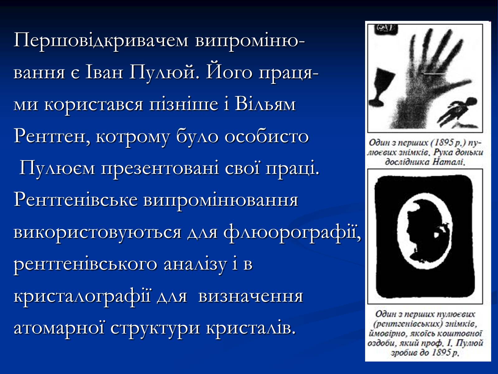Презентація на тему «Рентгенівське випромінювання» (варіант 10) - Слайд #6 Презентація на тему «Рентгенівське випромінювання» (варіант 10) - Слайд #6