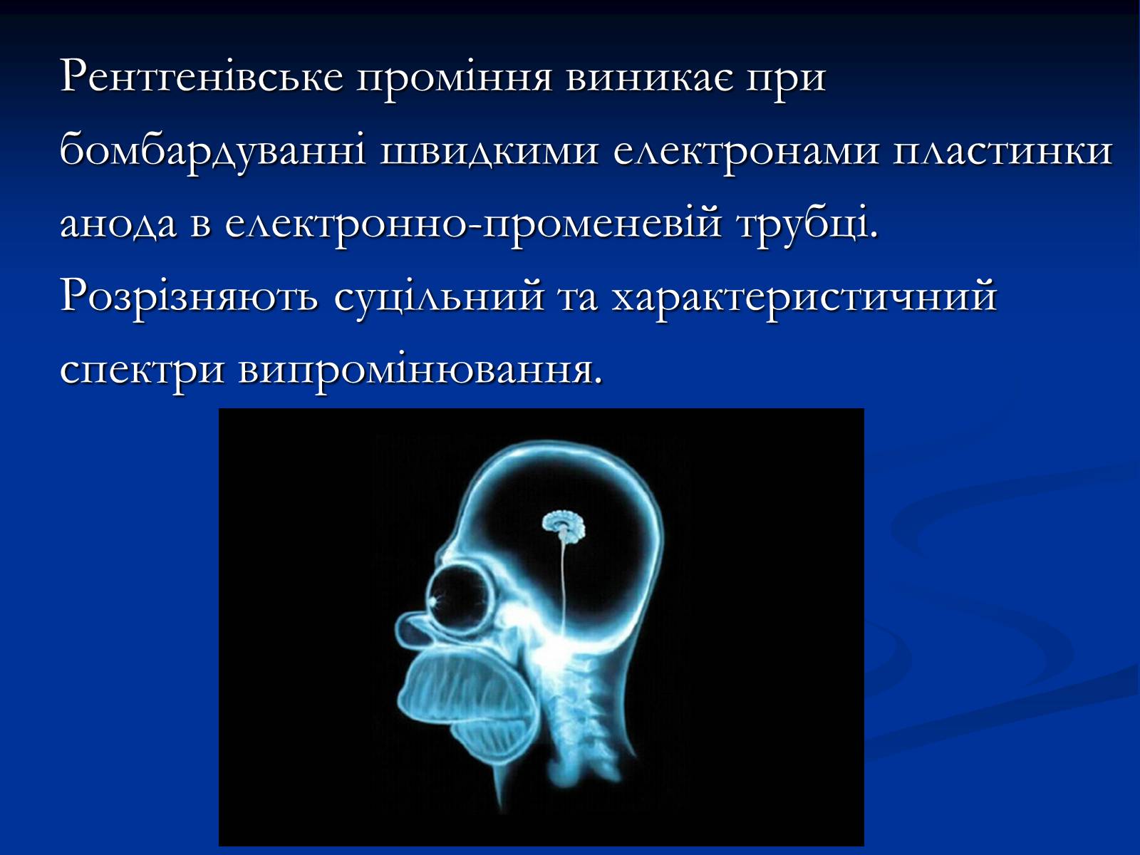 Презентація на тему «Рентгенівське випромінювання» (варіант 10) - Слайд #7 Презентація на тему «Рентгенівське випромінювання» (варіант 10) - Слайд #7