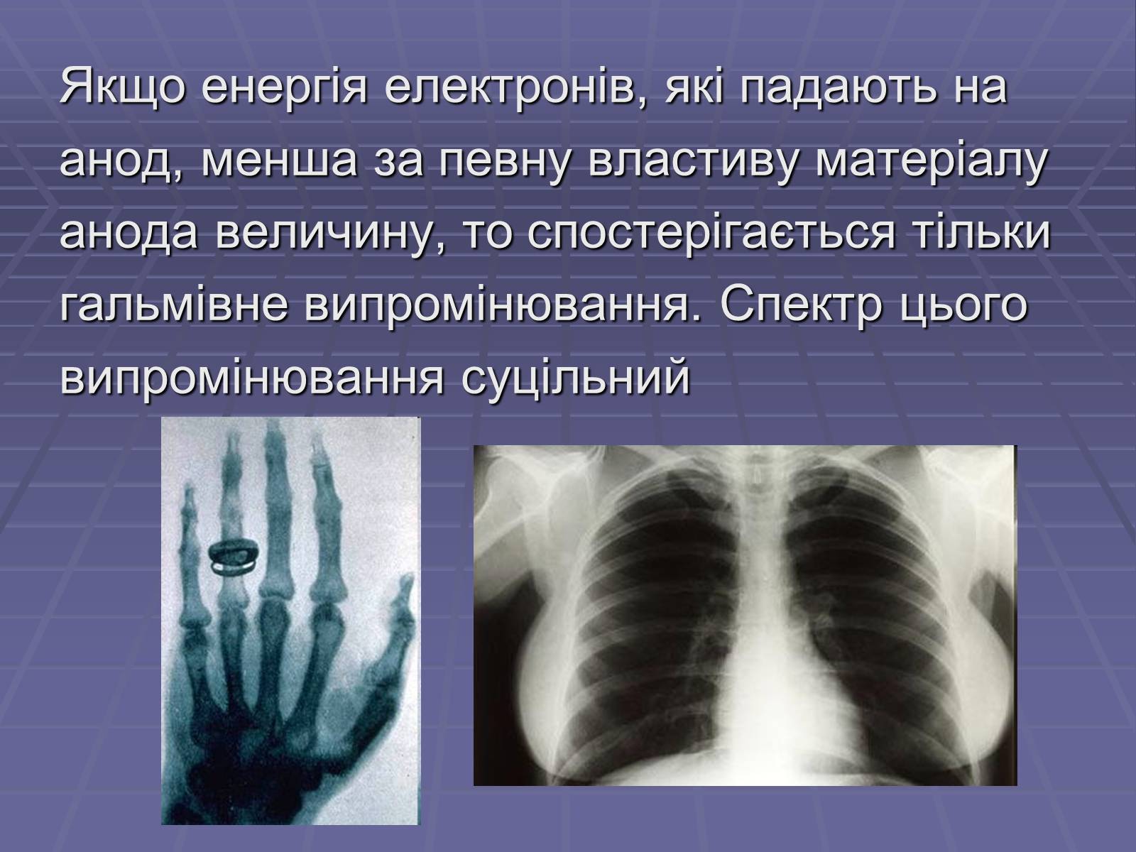 Презентація на тему «Рентгенівське випромінювання» (варіант 10) - Слайд #8 Презентація на тему «Рентгенівське випромінювання» (варіант 10) - Слайд #8