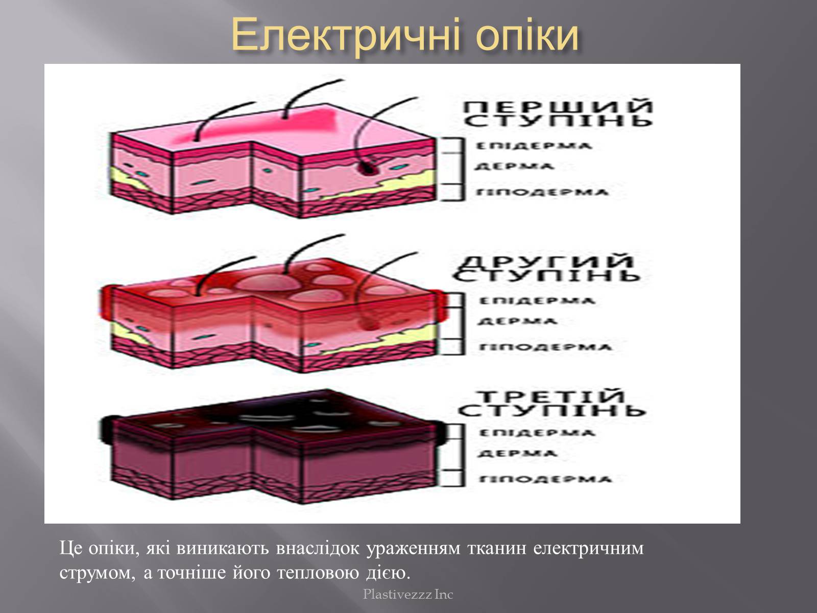Презентація на тему «Безпека при роботі з електричним струмом» - Слайд #5 Презентація на тему «Безпека при роботі з електричним струмом» - Слайд #5