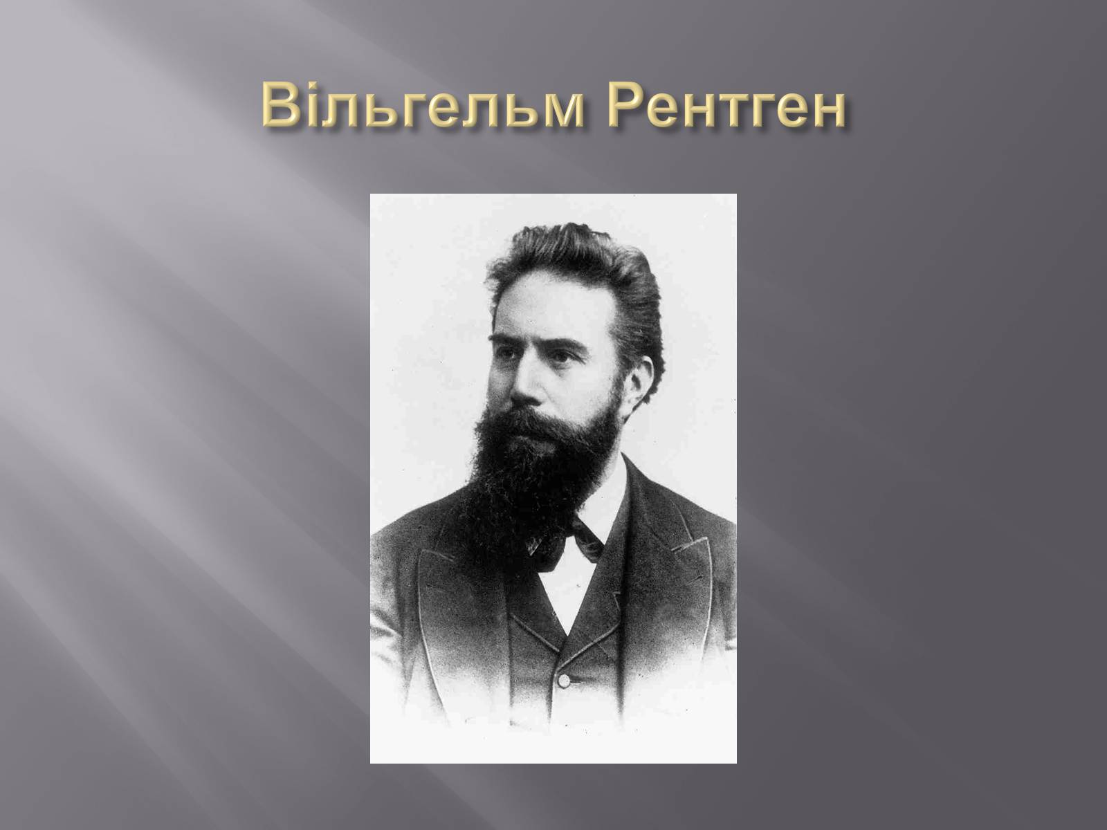 Презентація на тему «Рентгенівське випромінювання» (варіант 4) - Слайд #4 Презентація на тему «Рентгенівське випромінювання» (варіант 4) - Слайд #4